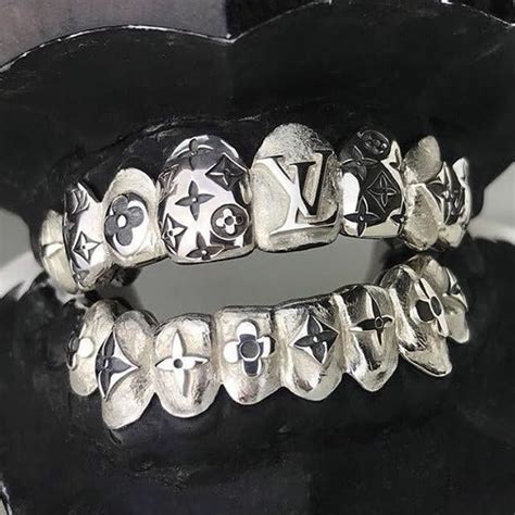 lv grillz|Custom LV grillz .